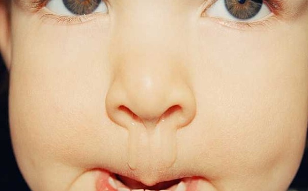 triệu chứng cơ bản của viêm mũi xuất tiết bội nhiễm